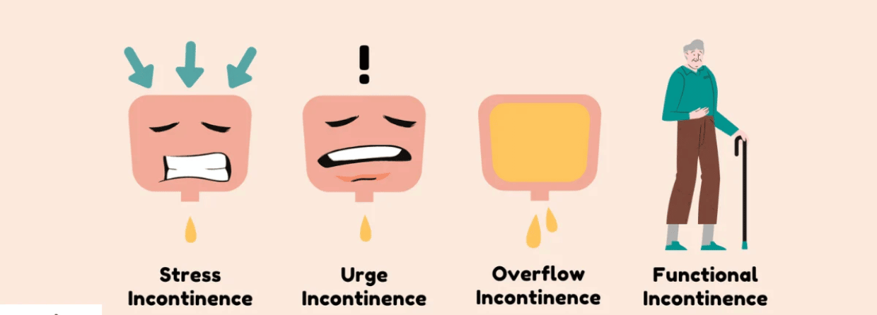 types of urinary incontinence