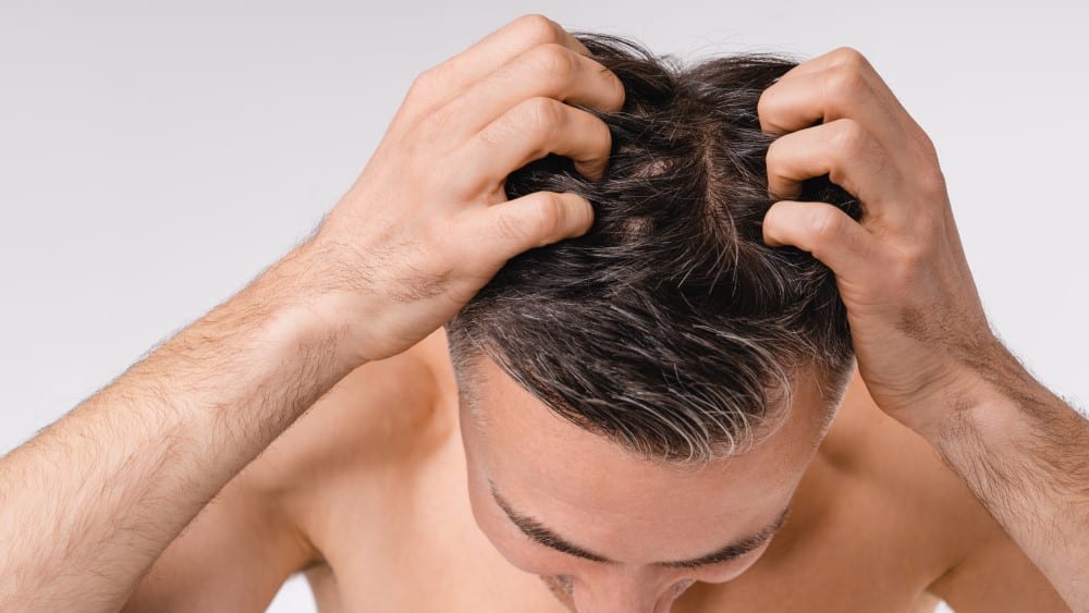 Hair Growth for Men: A Variety of Options